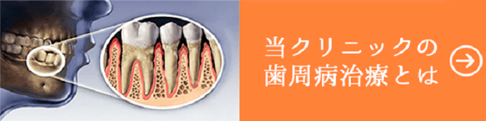 当院の歯周病外来とは