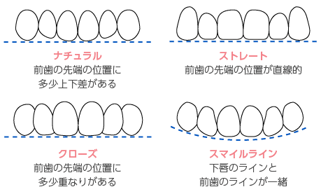 歯の並び方
